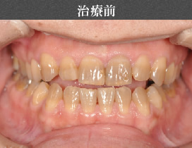 治療前