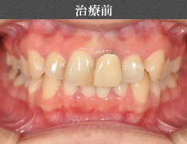 治療前